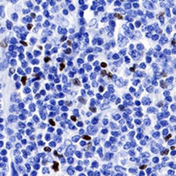 FOXP3 Rabbit Monoclonal Antibody