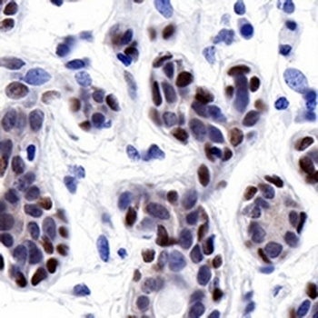 FOXP1 Rabbit Monoclonal Antibody