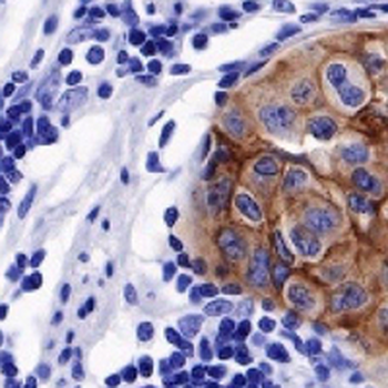 FGFR2 Rabbit Monoclonal Antibody