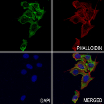 FGFR2 Rabbit Monoclonal Antibody