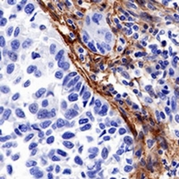 FAP alpha Rabbit Monoclonal Antibody