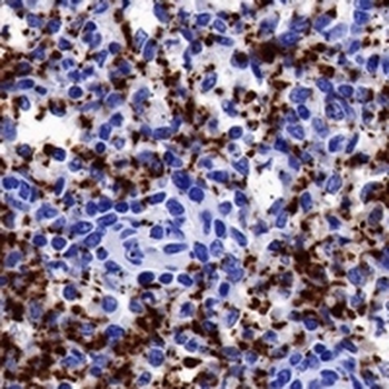 Factor XIIIa Rabbit Monoclonal Antibody
