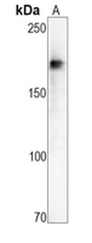 HER3 Rabbit Monoclonal Antibody