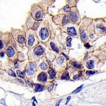 HER3 Rabbit Monoclonal Antibody
