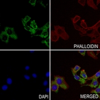 HER3 Rabbit Monoclonal Antibody