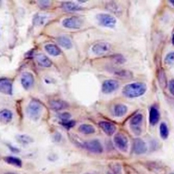 EPHA2 Rabbit Monoclonal Antibody