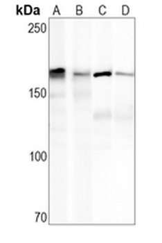 EGFR Rabbit Monoclonal Antibody