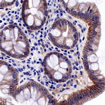 EGFR Rabbit Monoclonal Antibody