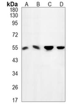 Desmin Rabbit Monoclonal Antibody