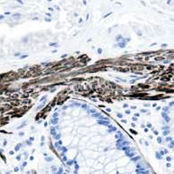 Desmin Rabbit Monoclonal Antibody