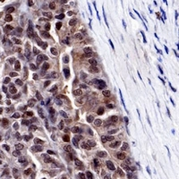 Cyclin D3 Rabbit Monoclonal Antibody