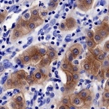 TNS4 Rabbit Monoclonal Antibody