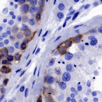 CTAG1B Rabbit Monoclonal Antibody