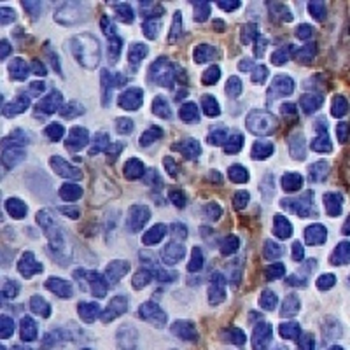 CD115 Rabbit Monoclonal Antibody