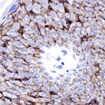 Claudin 1 Rabbit Monoclonal Antibody