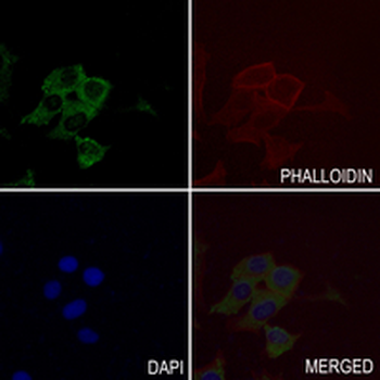 Claudin 1 Rabbit Monoclonal Antibody