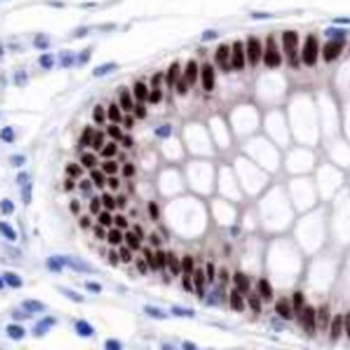 CDX2 Rabbit Monoclonal Antibody