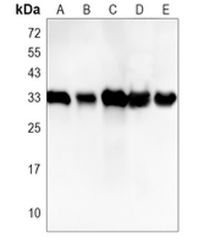 CDK2 Rabbit Monoclonal Antibody