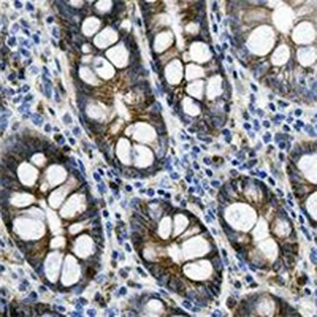 CD99 Rabbit Monoclonal Antibody