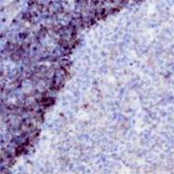CD79b Rabbit Monoclonal Antibody