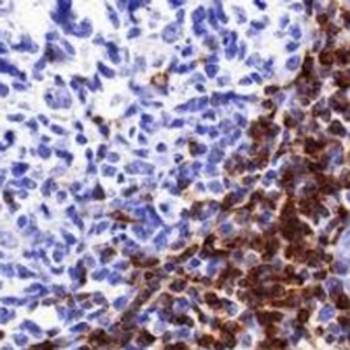 CD7 Rabbit Monoclonal Antibody