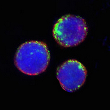 CD68 Rabbit Monoclonal Antibody