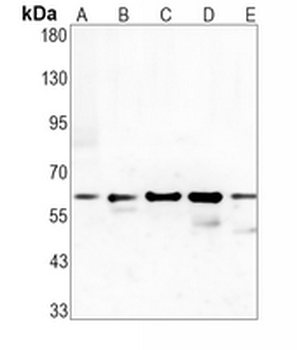 CD47 Rabbit Monoclonal Antibody