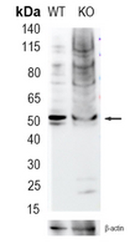 CD47 Rabbit Monoclonal Antibody
