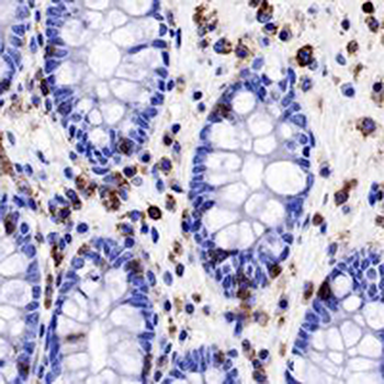 CD43 Rabbit Monoclonal Antibody