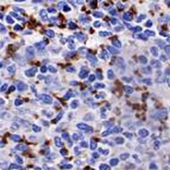 CD42b Rabbit Monoclonal Antibody