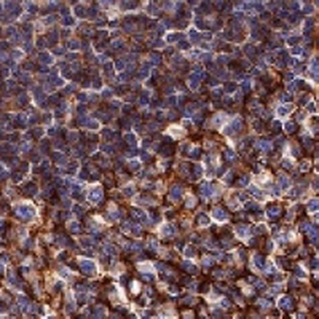 CD35 Rabbit Monoclonal Antibody