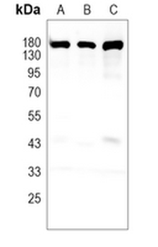CD31 Rabbit Monoclonal Antibody