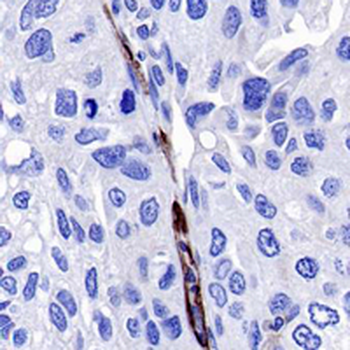 CD31 Rabbit Monoclonal Antibody