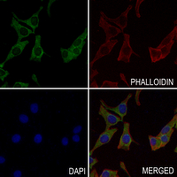 CD22 Rabbit Monoclonal Antibody