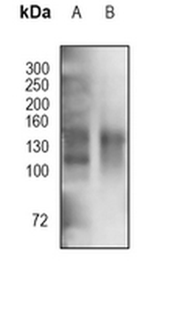 CD21 Rabbit Monoclonal Antibody