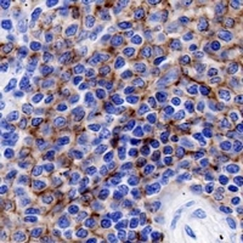 CD21 Rabbit Monoclonal Antibody