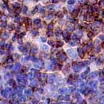 CD2 Rabbit Monoclonal Antibody