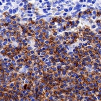 CD19 Rabbit Monoclonal Antibody