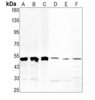 CD16 Rabbit Monoclonal Antibody
