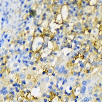 CD16 Rabbit Monoclonal Antibody