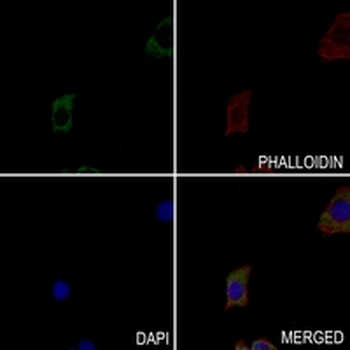 CD16 Rabbit Monoclonal Antibody