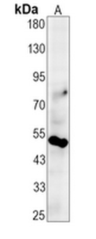 CD16 Rabbit Monoclonal Antibody