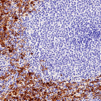 CD16 Rabbit Monoclonal Antibody