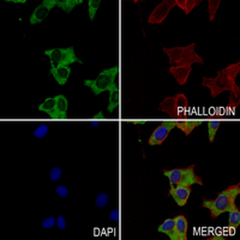 CD169 Rabbit Monoclonal Antibody
