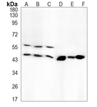 CD14 Rabbit Monoclonal Antibody