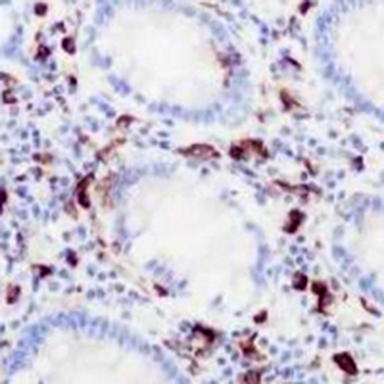 CD14 Rabbit Monoclonal Antibody