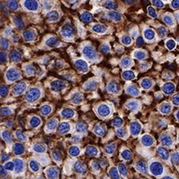 CD138 Rabbit Monoclonal Antibody