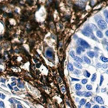 CD13 Rabbit Monoclonal Antibody