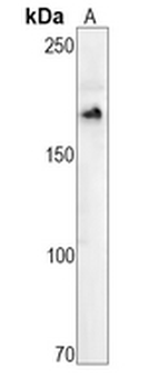 CD11b Rabbit Monoclonal Antibody