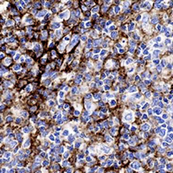 CD11b Rabbit Monoclonal Antibody